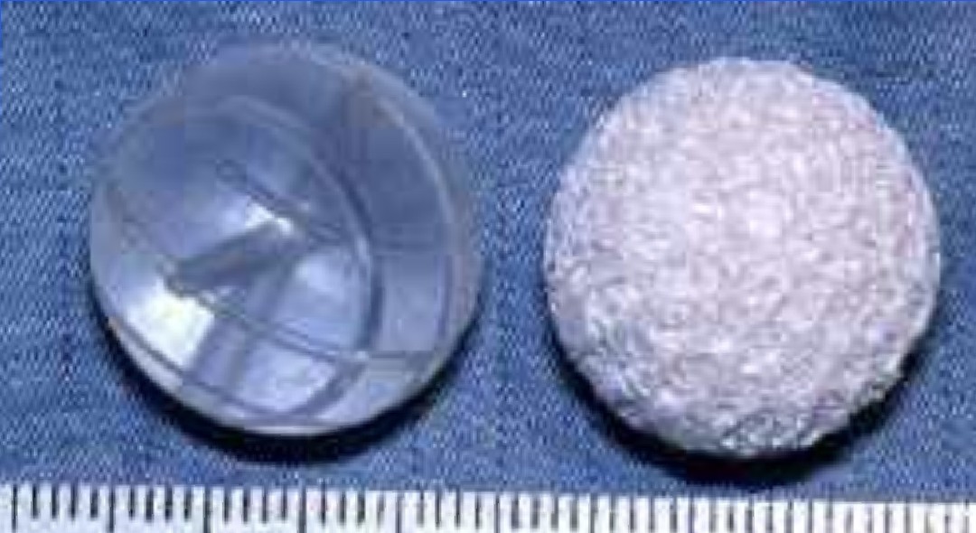 Geimplanteerd Bolletje